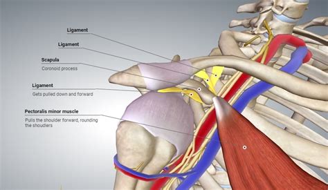 Thoracic Outlet Syndrome – Remedial Massage Can Help