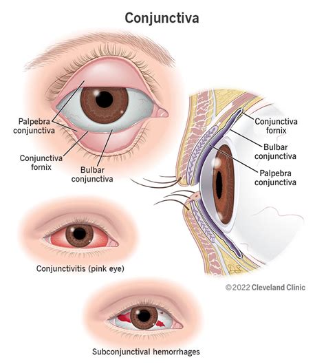 Conjunctiva: Anatomy, Function & Common Conditions