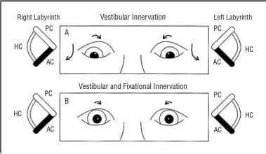 SUPERIOR OBLIQUE MUSCLE OVERACTION - Optography