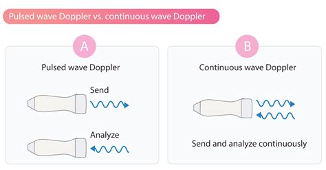 Continuous Wave Vs Pulse Wave Doppler - Davis Plut1961