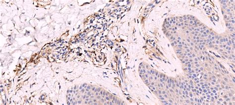 Neprilysin/CD10 Antibody (NBP2-15771): Novus Biologicals