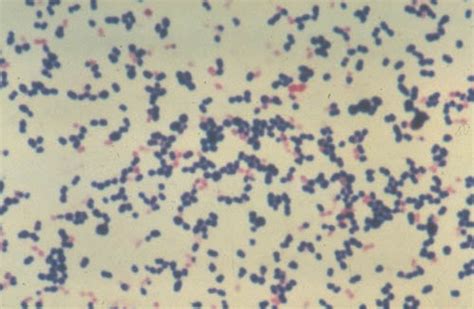 Gram Negative Cocci In Clusters