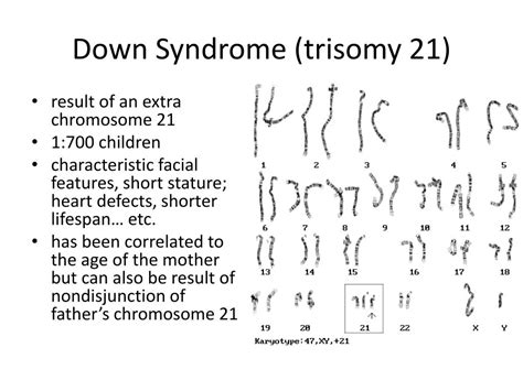 PPT - Down Syndrome ( trisomy 21) PowerPoint Presentation, free ...