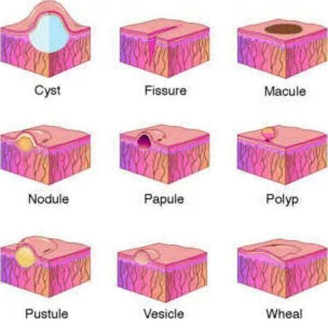 Classification of skin lesions #FutureDentalHygienist | Nurse, Nursing ...