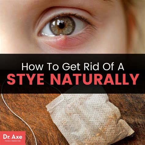 How to Use Cucumbers, Potatoes and Black Tea to Heal a Stye (No Meds ...