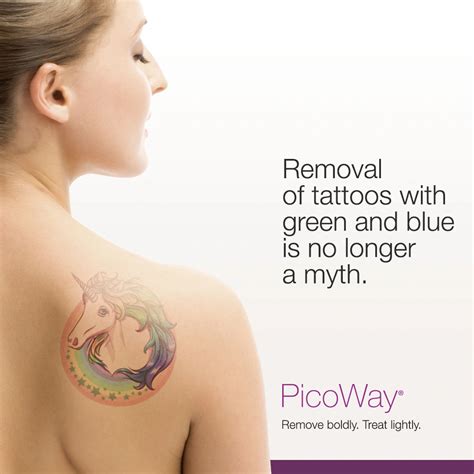 PicoWay Laser Tattoo Removal – Synergy Medical Aesthetics – Nanaimo ...