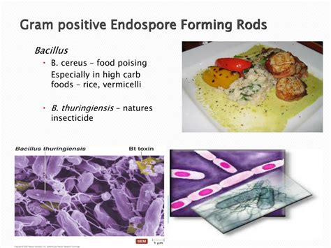 Ppt Diagnostic Microbiology Lecture Gram Positive Endospore | SexiezPix ...