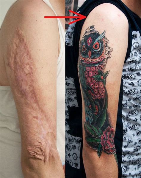 Details more than 76 burned skin tattoo - in.coedo.com.vn