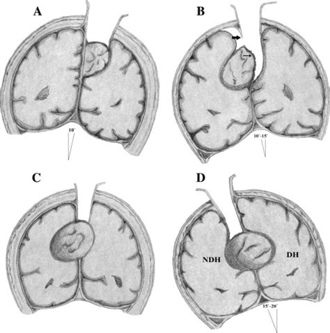 A proposed scheme for the classification and surgical planning of ...