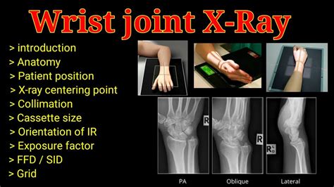 X Ray Wrist Lateral View