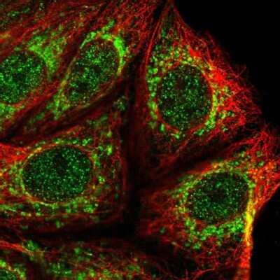 Mitochondrial ribonuclease P protein 3 Antibody (NBP2-13619): Novus ...