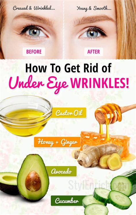 How to Get Rid of Under Eye Wrinkles or Under Eye Creases! – StylEnrich