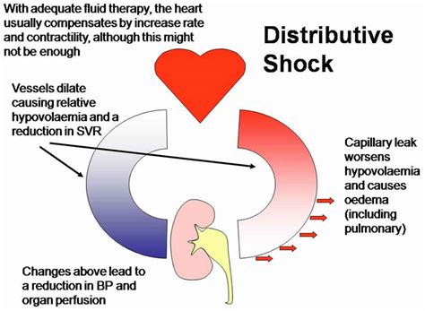 What Is Shock Definition Causes Symptoms And Different Types ...