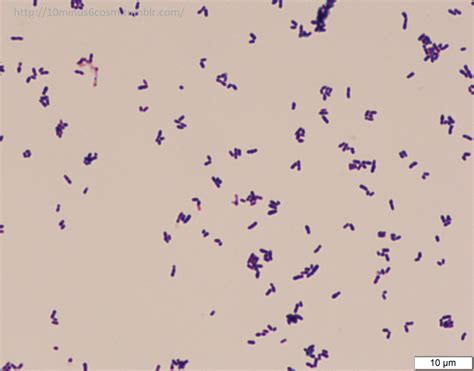 Corynebacterium Gram Stain