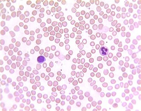 Histology at SIU, blood cells