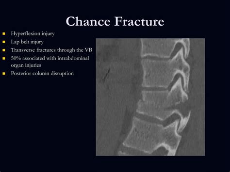 PPT - Traumatic Spine and Spinal Cord Injuries PowerPoint Presentation ...