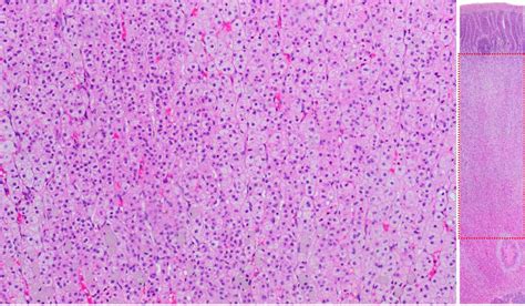 Adrenal gland – Veterinary Histology