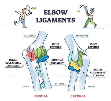 Elbow ligaments with medical medial or lateral xray structure outline ...