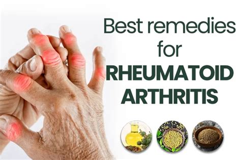 Arthritis Treatment: Discover the Best Home Remedies