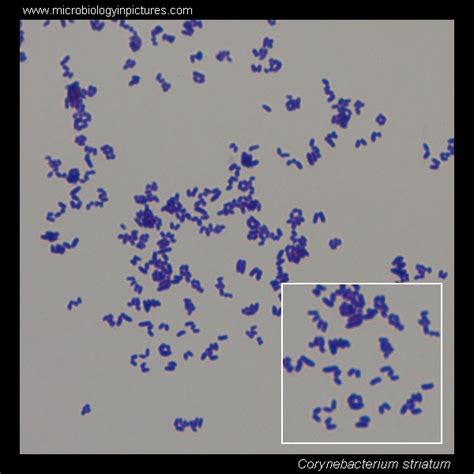 Corynebacterium microscopy. Corynebacterium Gram-stain and cell ...