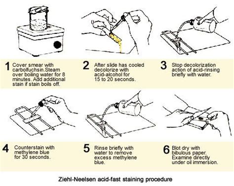 Ziehl-Neelsen acid-fast staining procedure | Medical Laboratories