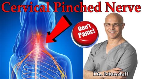 How to Overcome Cervical Pinched Nerve & Radiculopathy (Don't Panic ...