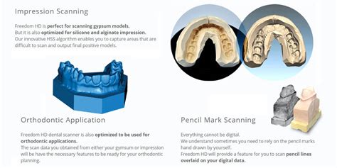 DOF dental scanner | intelligent dental solutions