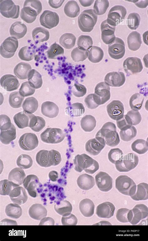 Platelets microscope hi-res stock photography and images - Alamy