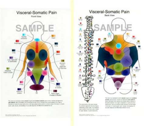 Visceral Somatic Pain Posters and Charts