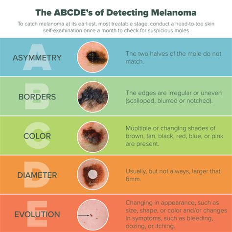 Dangers of Melanoma - Skin Cancer Awareness Month