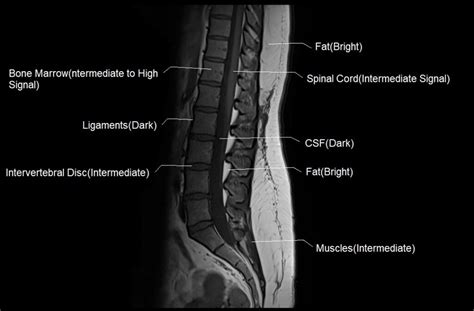 T1 vs T2 MRI | T1and T2 MRI image comparison