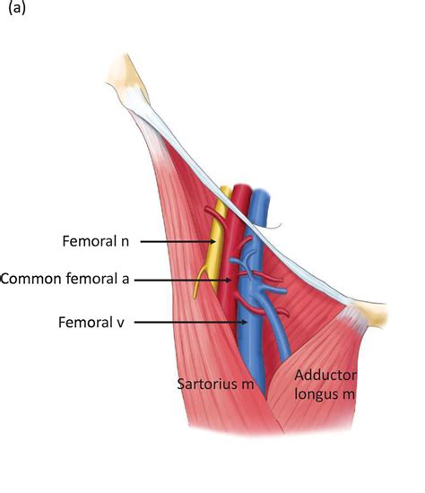 Femoral Triangle Surface Anatomy