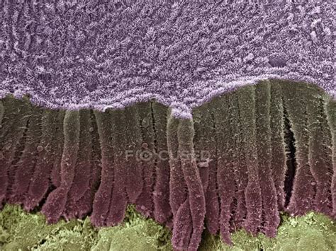 Coloured scanning electron micrograph (SEM) of a fractured bile duct ...