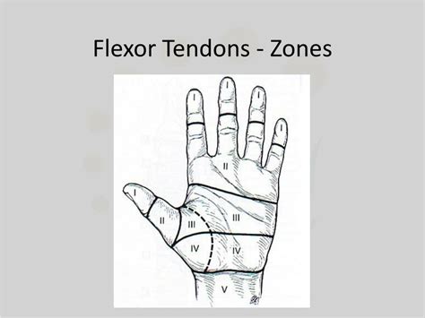 Flexor Zones Of The Hand