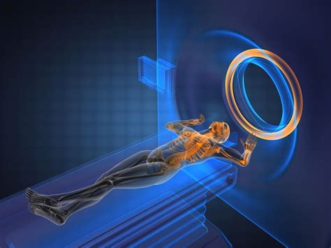 MRI Scan | Magnetic resonance imaging, Mri, Magnetic resonance