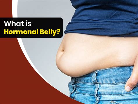 Hormonal Belly: Know Causes, Symptoms And Treatment | OnlyMyHealth