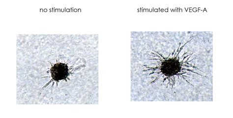 Angiogenesis Assay Service for Drug Discovery | Reaction Biology