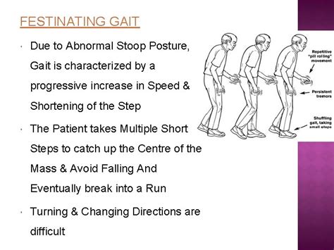 Definition of FESTINATING GAIT HOEHN AND YAHR CLASSIFICATION