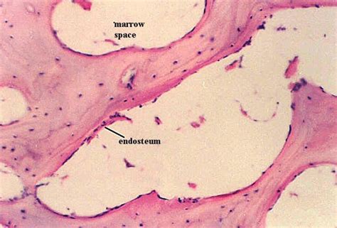 SPONGY BONE HISTOLOGY | Microanatomy Web Atlas | Gwen V. Childs, Ph.D.