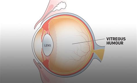 I Have Noticed Flashing In The Side Of My Right Eye Vision.