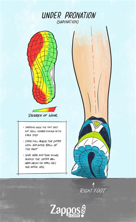 Type of Pronation | Zappos.com