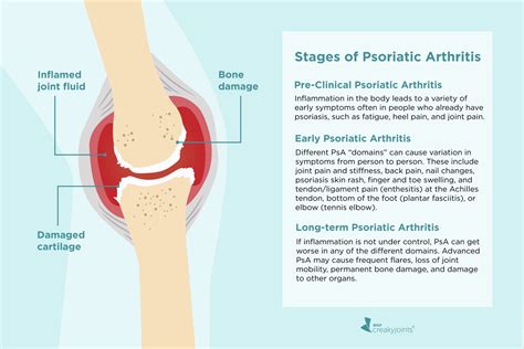 What Happens If Arthritis Is Left Untreated: The Silent Consequences