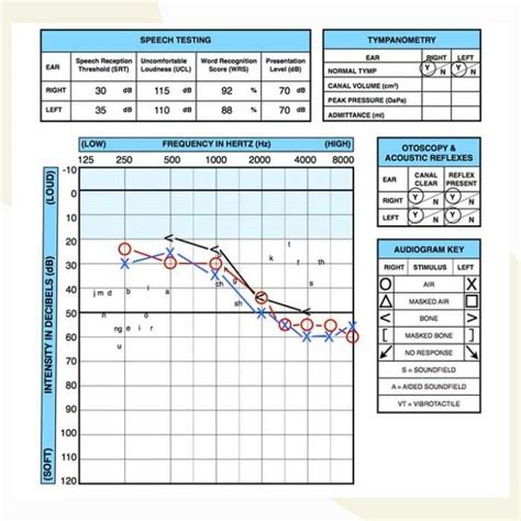 How to Read an Audiogram | Dr. Amy Sarow Explains