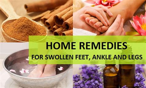 Home Remedies for Swollen Feet, Ankle and Legs