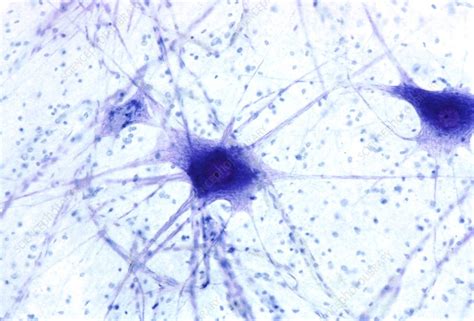 Human Nerve Cells Under Microscope