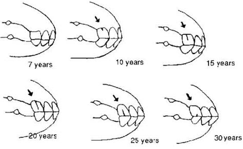 A Horse's Teeth: What Can We Learn, Age, Health, And More?