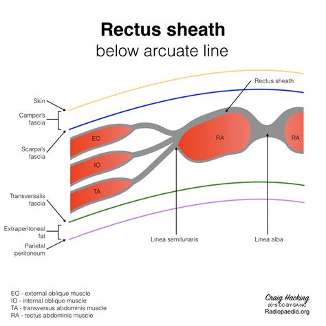 Rectus sheath (diagram) | Image | Radiopaedia.org