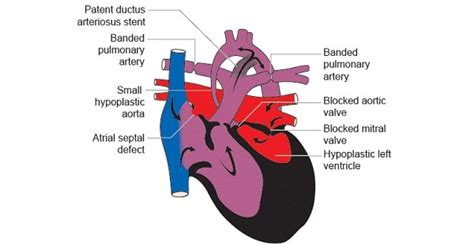 Autopsy: Procedure - www.medicoapps.org