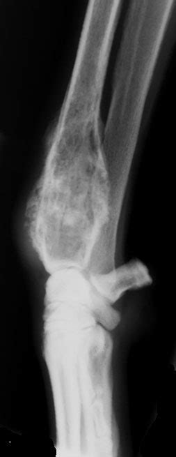 Fibrosarcoma in Dogs (Canis) | Vetlexicon