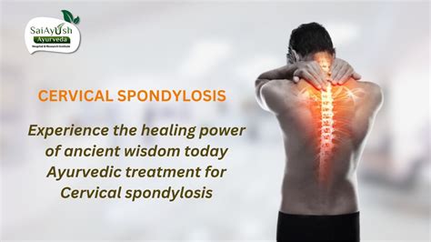 Cervical Spondylosis Treatment: Natural Solutions